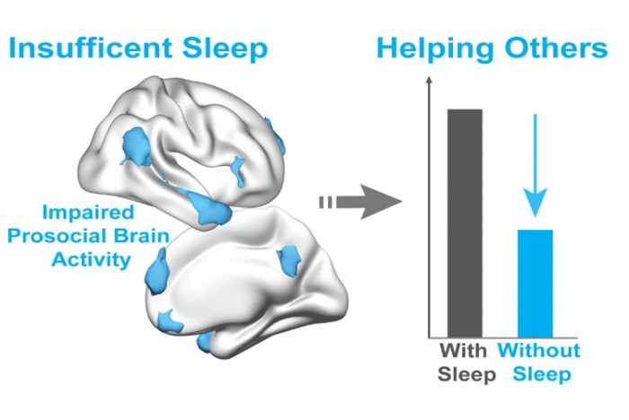 brainandsleep750px.jpg